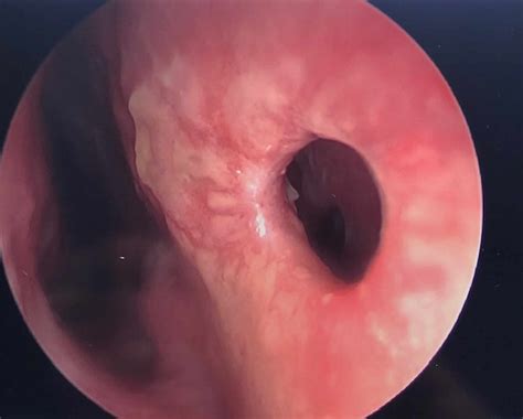 View of a right nasal cavity. Nasal Septum / The nasal septum is comprised of three ...