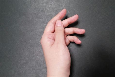 手のひらの湿疹の原因とは？痛みやかゆみのある病気って ...