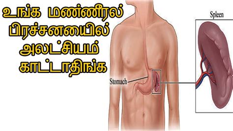 Views 42k3 in this video : உங்க மண்ணீரல் பிரச்சனையில் அலட்சியம் காட்டாதிங்க ...