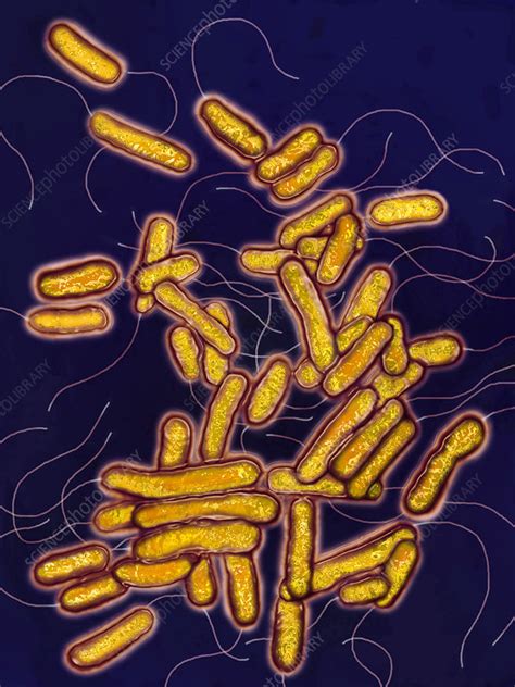 Legionella pneumophila serogroup 1 pneumonia recurrence postbone marrow transplantation. Legionella pneumophila bacteria, LM - Stock Image - C028 ...