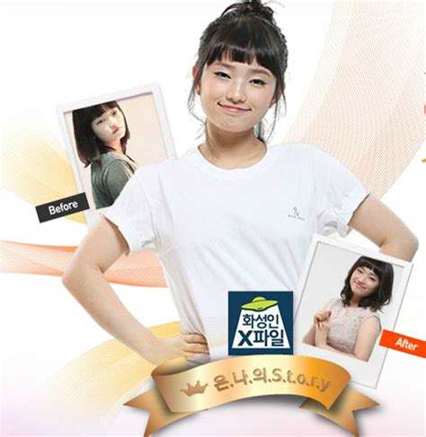 강남 원진 성형외과 출신 한나이브성형외과 대표원장 눈성형 마스터 다양한 케이스의 임상경험. 박은나 H컵→C컵 가슴수술 후 당당해진 모습 공개 - 아주경제