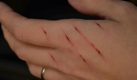 Rub catnip on the scratching post. 7 ways to treat cat scratches on children naturally at ...