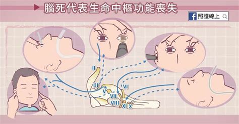 Coma and brain death （昏迷與腦死）. 植物人不等於腦死 - 認識小腦與腦幹（懶人包） - 照護線上