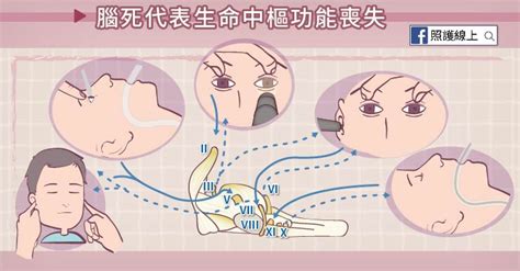 Coma and brain death （昏迷與腦死）. 植物人不等於腦死 - 認識小腦與腦幹（懶人包） - 照護線上