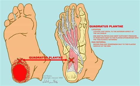 Myalgia in itself, is a symptom, probably of an underlying condition. Quadratus plantae myalgia - trattamento ed esercizi a casa.