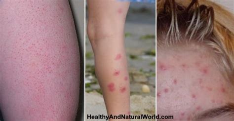 Red spots can be caused by a variety of conditions, including infections, allergic reactions, and inflammatory processes. Red Spots on Skin: Causes, Treatments and More (Extensive ...