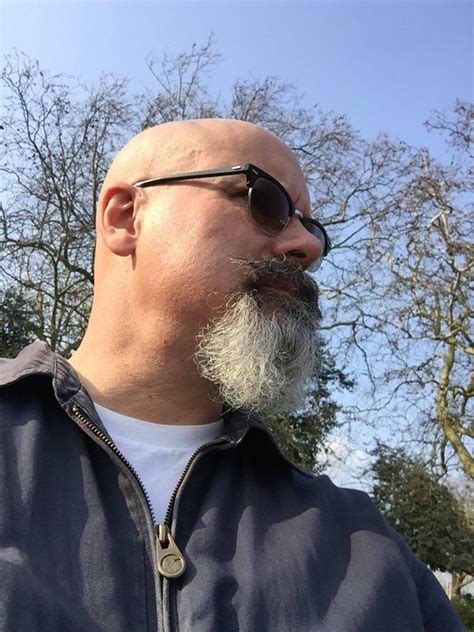 Excessive chin or facial hair, or suddenly increased growth in hair on any part of the face, may be a sign of a condition called hypertrichosis. Why can a bald man grow a beard? Isn't beard just hair ...