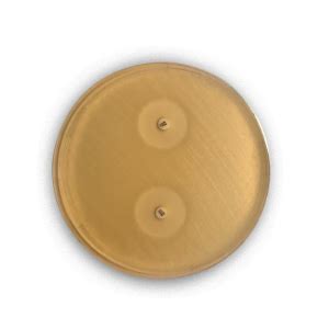 This formula conforms to clinical and laboratory standard institute (clsi). Mueller Hinton Agar (150 mm Petri) | RTA