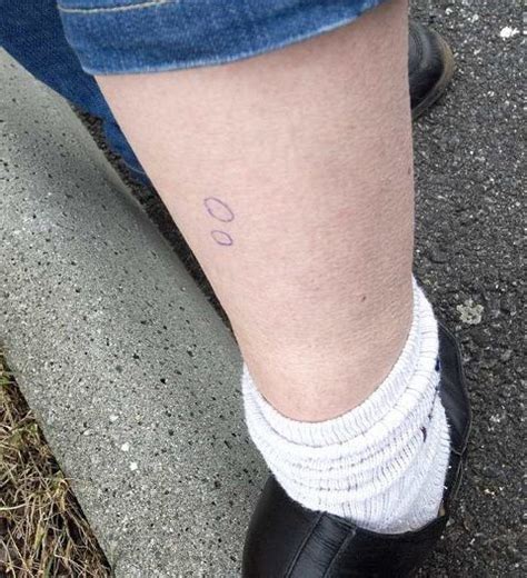 For å minske sjansen for at giften sprer seg i kroppen, finnes det noen enkle triks. Kraftig bitt: Hoggormen som bet Hanne Merethe Kjærulf ...