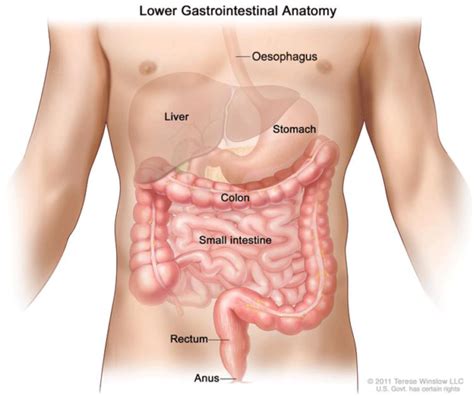 Bowel cancer is one of the most common causes of cancer death in new zealand. Bowel cancer symptoms & stastics | Bowel Cancer NZ
