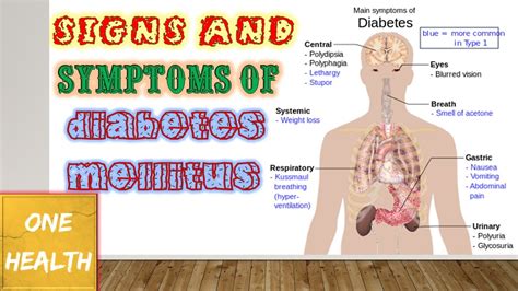 Although the exact cause of type 1 diabetes is unknown, factors that may signal an increased risk include: Signs and symptoms of diabetes mellitus - One Health - YouTube