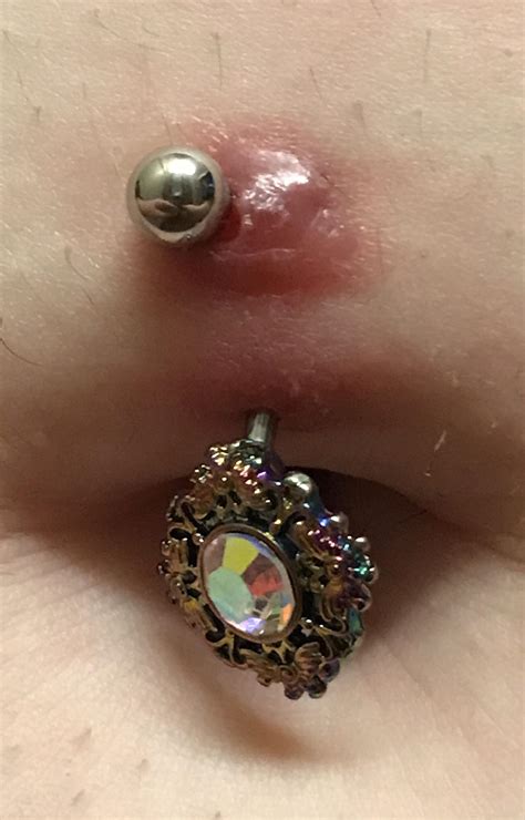 Your computer freezes, hangs or is unresponsive. Is my belly button ring infected or rejecting? I've ...