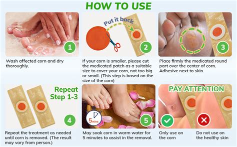 Check spelling or type a new query. Amazon.com: Corn Remover, 24 Corn Remover Pads, Toe Corn ...