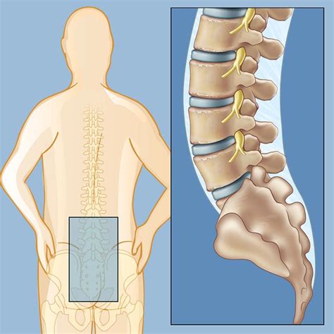 Upper and inner thigh common functions: Low Back Pain Detail And Physiotherapy Treatment