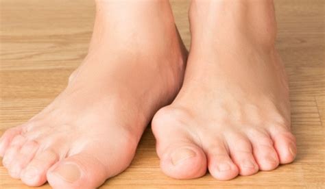 Gout adalah penyakit yang boleh. Makanan & Gout, Saintis Ni Kongsi Infonya. Ambil Perhatian ...