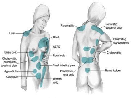 Up to 75% of patients with unresolved chronic back pain also have a history stomach and back pain is statistically one of the most common of all combination pain syndromes involving multiple areas of the body without direct. Pin on Medicine Cabinet