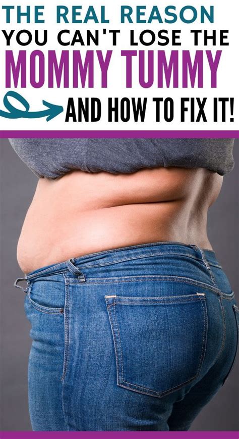 How do i know if i have diastasis recti? Diastasis recti: how to fix the problem through exercise ...