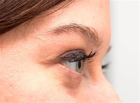 Feb 21, 2021 · diez cosméticos para tratar las ojeras, bolsas y párpados caídos una experta en dermocosmética nos explica cómo cuidar esta zona del rostro y los productos que mejor actúan en cada caso. Ácido hialurónico para las ojeras | Medicina Estética en ...