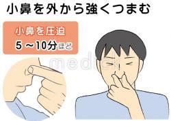 鼻濁音（びだくおん）とは、日本語で濁音の子音（有声破裂音）を発音するとき鼻に音を抜くものを言う。音声上はま行子音 /m/ やな行子音 /n/ と同じ鼻音であり、ガ行子音/ɡ/における鼻濁音（ガ行鼻濁音）ならば、軟口蓋鼻音ŋである。 鼻血の止血のイラスト - 医療のイラスト・写真・動画、素材 ...
