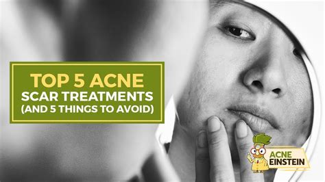 One of the simplest remedies for acne is keeping your skin clean and moisturized. How to get rid of your acne scars? - YouTube