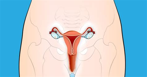(redirected from cancer of the cervix). 10 Early Warning Signs of Cervical Cancer That Women ...