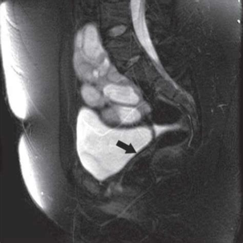 A review laura londra, farah s chuong, lisa kolpdivision of reproductive endocrinology and infertility, department of gynecology and obstetrics, johns hopkins university, baltimore, md, usaabstract. Fehlbildungen der weiblichen Geschlechtsorgane