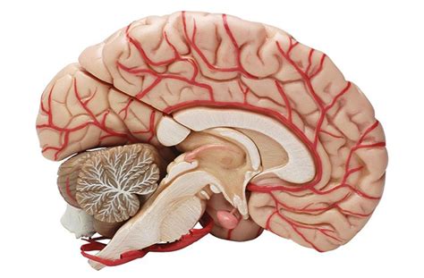 Infarto lacunar (en pacientes con hipertensión vascular), infartos dependientes de las carótidas (por. Edema Cerebral ⇒ 【↓Causas, Síntomas y Tratamiento↓】