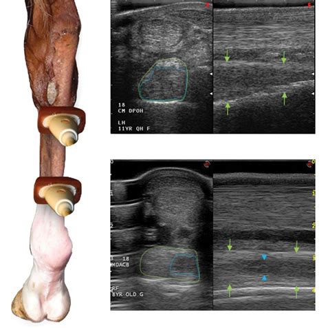 • extensor muscle belly • usually from penetrating trauma • often have associated neurologic injury • tendon repair followed by immobilization with elbow in flexion and wrist in extension. Suspensory Ligament Injuries in Dressage Horses | Ligament ...