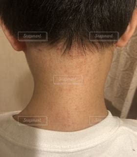 大人女性の汗かぶれの写真・画像素材3308824-Snapmart（スナップ ...