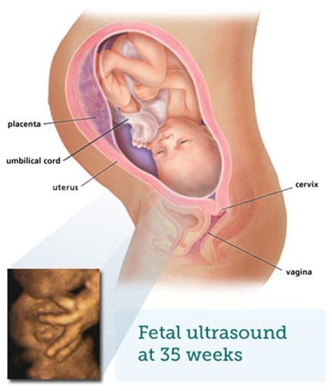 If you're 35 weeks pregnant, you're in month 8 of your pregnancy. Fetal ultrasound - 8 months - BabyCentre UK