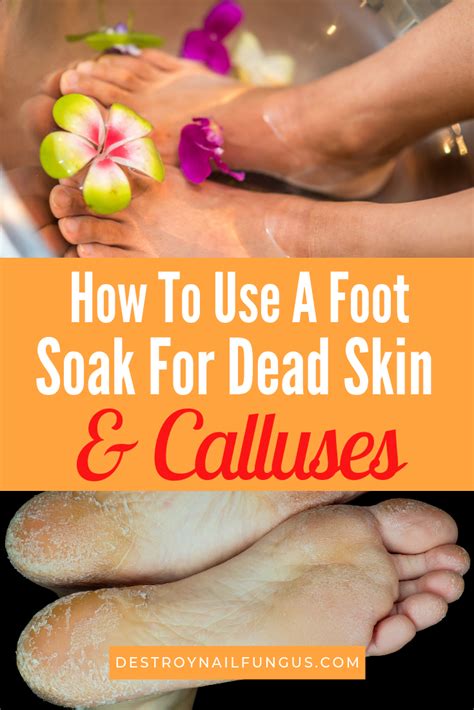 Walmart.com has been visited by 1m+ users in the past month How To Use A Foot Soak To Remove Dead Skin And Calluses