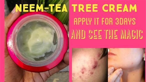 Participates in physiological processes involving bile acids, conjugated steroids and cyclic nucleotides. How to get rid of acne pimple fast/101% result/girl on the ...