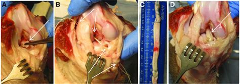 We did not find results for: ACL Reconstruction Model in Yucatan Mini-Pig Knee Joints ...