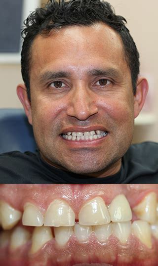 They would know what is happening in those facilities. Gallery | Family & Cosmetic Dentistry by Brampton Dentist ...