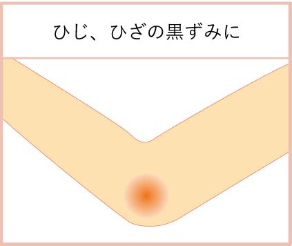 町田製薬株式会社 公式サイトたこの吸出しユリア軟膏