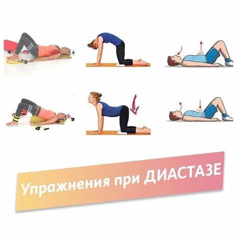 Какие делать упражнения чтобы убрать живот после родов в домашних условиях