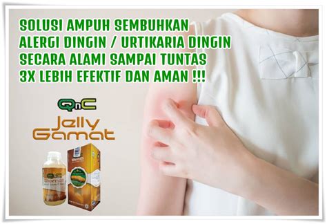 Cara Menyembuhkan Alergi Dingin Secara Alami Terbukti ...