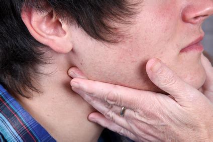 Das pfeiffersche drüsenfieber wird durch küssen übertragen. Pfeiffersches Drüsenfieber: Symptome, Diagnose und Behandlung