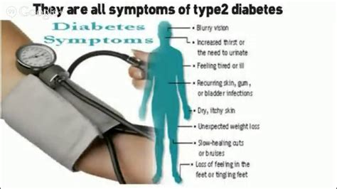 Diabetes mellitus refers to a group of diseases that affect how your body uses blood sugar (glucose). diabetes symptoms in men Diabetes kills diabetes symptoms ...