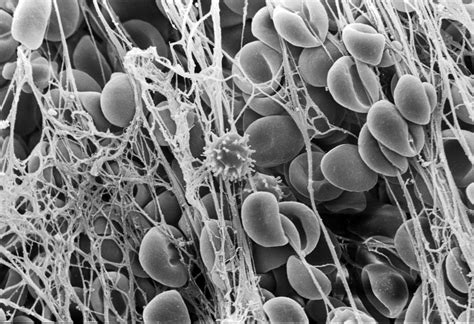 Liver bud arise from foregut endoderm towards septum transversum (developing diaphragm) in response to signals from nearby mesoderm. 100 Ways that Aging Affects the Body: Overview of the ...