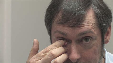 How to remove contact lenses. remove contact lenses, remove contact lenses question and ...