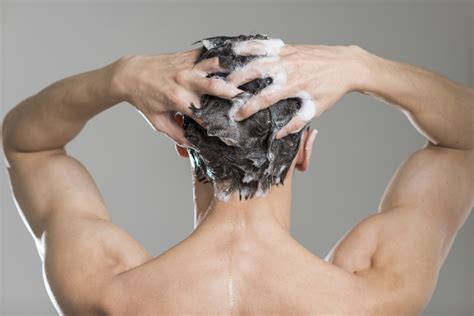 It could be scaly scalp. How Men Can Take Care of a Dry Scalp - South Florida Reporter