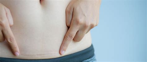 39 Top Images Ab Wann Rückbildung Nach Kaiserschnitt ...