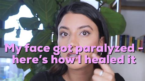 Signs and symptoms of bell's palsy come on suddenly and may include: Home treatment for Bell's Palsy - Philadelphia Holistic Clinic