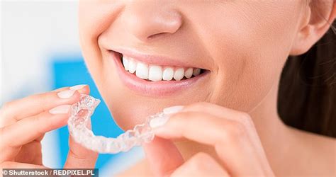 Bring back your teeth together. Dentists warn do NOT buy cheap and dangerous 'DIY braces' | Daily Mail Online