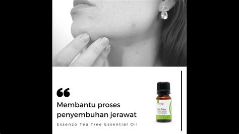 Cara Menghilangkan Jerawat - YouTube