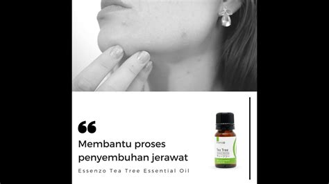 Maybe you would like to learn more about one of these? Cara Menghilangkan Jerawat - YouTube