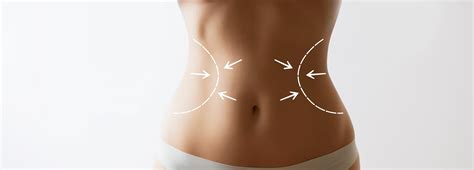 Patients who return to old (unhealthy) habits after their procedure can lose all the enhancements the procedure allowed. Lipo 360 in Raleigh | Circumferential Trunk Liposuction ...