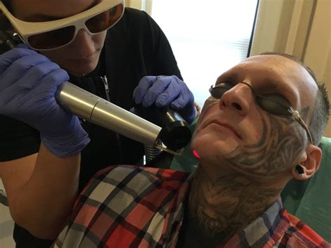 She previously served in the south carolina house of representatives from 2011 to 2016. Tattoo Removal Programs Help Former Inmates Wipe The Slate ...