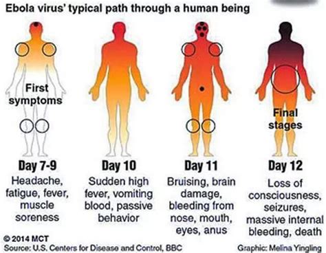 The virus itself is really nothing special—until it gets inside a human. Troops Deployed In West Africa Ebola Clinics As 2 More ...